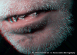 Lips
